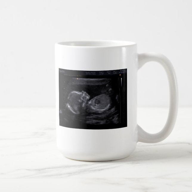 Tasse customisée d'ultrason (Droite)