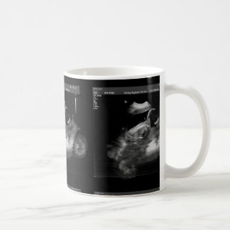 Tasse de sonogramme de moto