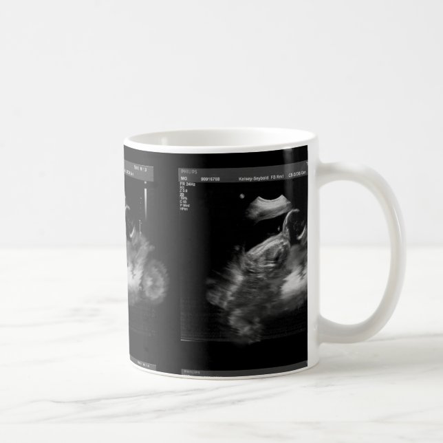 Tasse de sonogramme de moto (Droite)