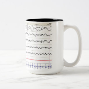Tasse d'EEG - sommeil de rem
