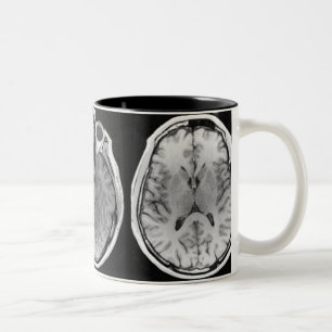 Tasse d'image de cerveau d'IRM