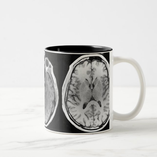 Tasse d'image de cerveau d'IRM (Droit)