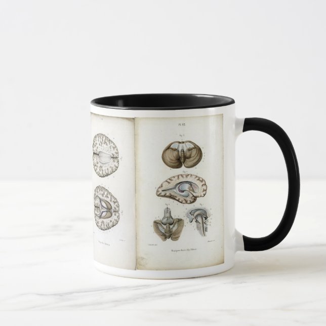 Tasse d'impression d'anatomie de cerveau (Droite)