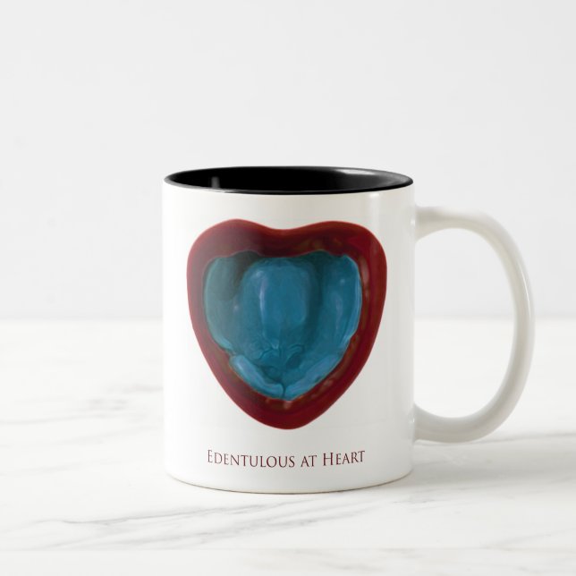 Tasse édentée (Droit)