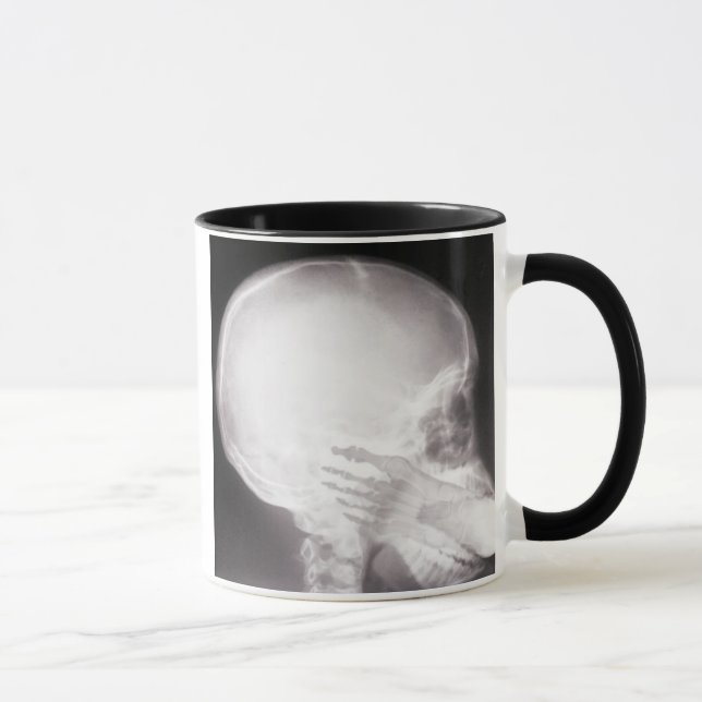 Tasse Foot à Mouth X-Ray (Droite)