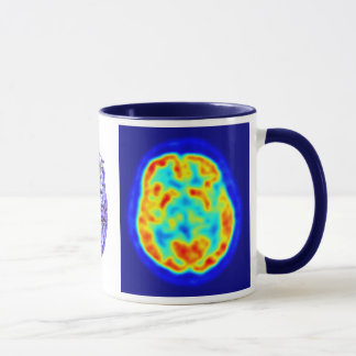 Tasse Image de cerveau