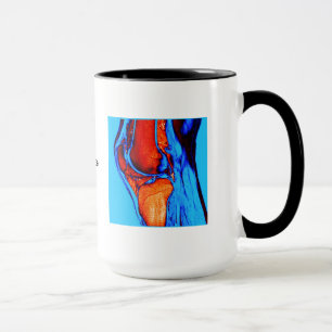 Tasse IRM de genou