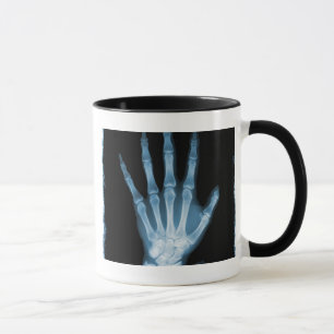 Tasse Main bleue de squelette de rayon X