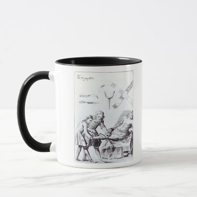 Tasse Opération chirurgicale pour amputer une jambe (Gauche)