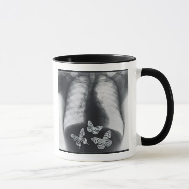 Tasse Rayon X des papillons dans l'estomac (Droite)