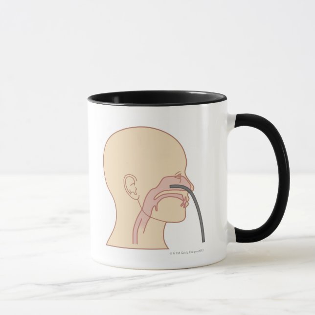 Tasse Rhinoscopy antérieur (Droite)