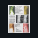 Tear Off Pad Lumbar Spinal Degeneration<br><div class="desc">Radiology views of the lumbar spine showing the 4 phases of spinal degeneration. Colour coded to help explain xrays during report of findings with your patient. Common conditions are listed with each phase. Patient education handout for the chiropractic clinic.</div>