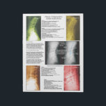 Tear Off Pad Lumbar Spinal Degeneration<br><div class="desc">Radiology views of the lumbar spine showing the 4 phases of spinal degeneration. Colour coded to help explain xrays during report of findings with your patient. Common conditions are listed with each phase. Patient education handout for the chiropractic clinic.</div>