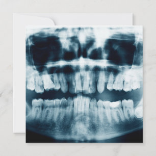 Teeth X-ray