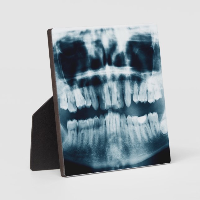 Teeth X-ray Plaque (Front)