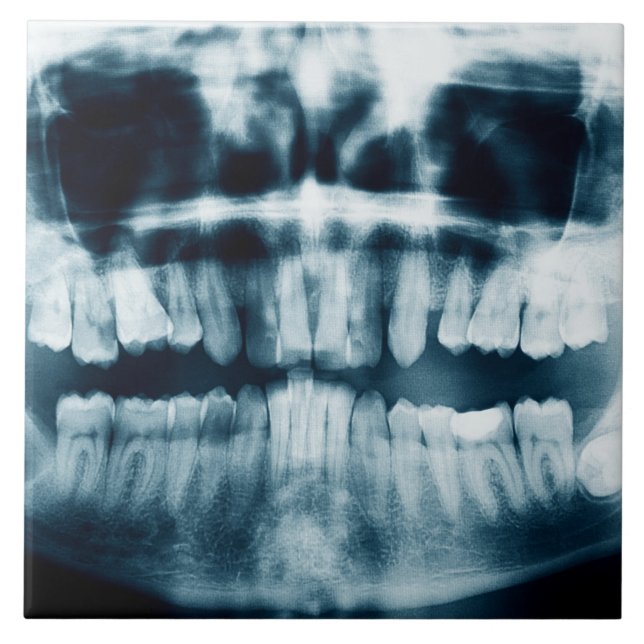Teeth X-ray Tile (Front)