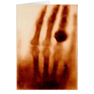 The First X-Ray, 1901, Photograph
