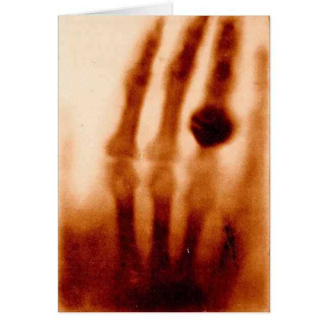 The First X-Ray, 1901, Photograph (Front)