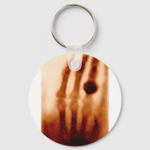 The First X-Ray, 1901, Photograph Keychain