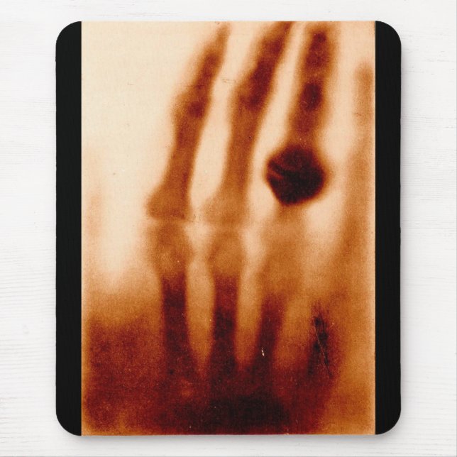 The First X-Ray, 1901, Photograph Mouse Pad (Front)