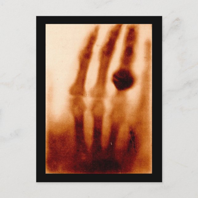 The First X-Ray, 1901, Photograph Postcard (Front)