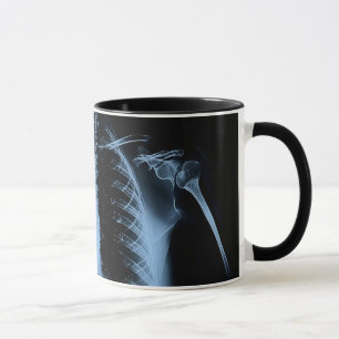 The X-ray Mug