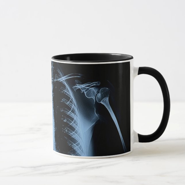 The X-ray Mug (Right)