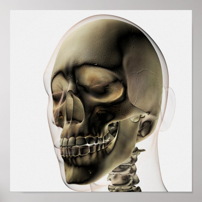 Three Dimensional View Of Human Skull And Teeth Poster (Front)