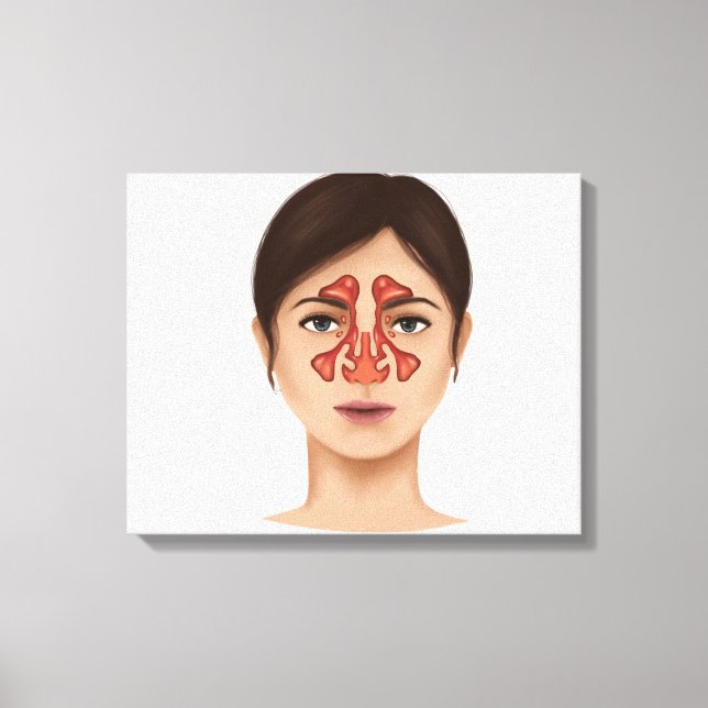Toile Anatomie Des Sinus Nasaux (Recto)