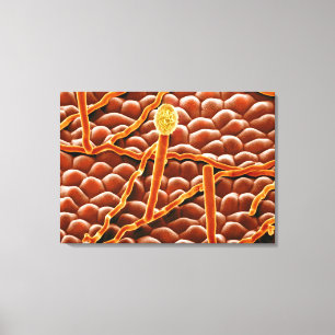 Toile Champignon de rouille pulvérulente sur la