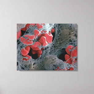 Toile Clot de sang 2