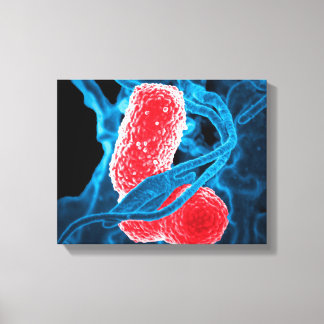 Toile (MDR) Klebsiella pneumoniae biologie artistique ab