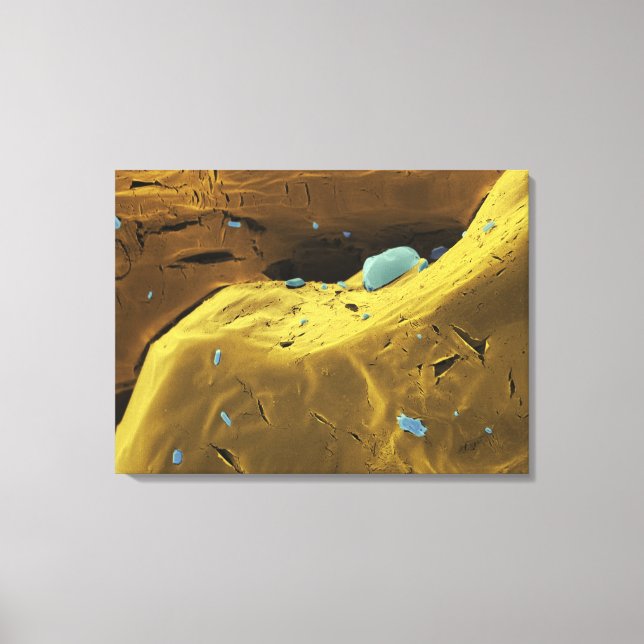 Toile Poudre d'urée (Recto)