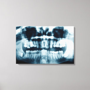 Toile Rayon X des dents