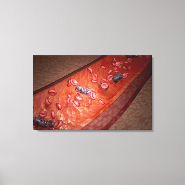 Toile Rendu microscopique d'une infection sanguine (Recto)