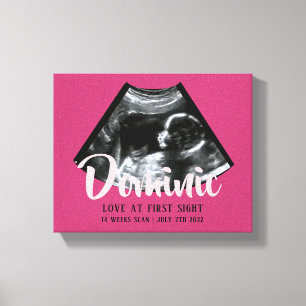 Toile Sonogramme Keepsaké Baby Ultrasound Canvas Imprim