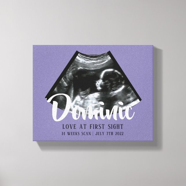 Toile Sonogramme Keepsaké Baby Ultrasound Canvas Imprime (Recto)