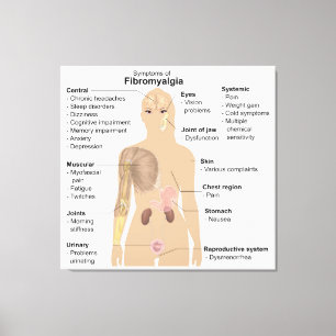 Toile Symptômes du graphique Fibromyalgie Tableaux impri