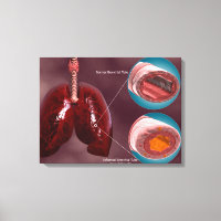 Trachea Transsection Avec Poumons