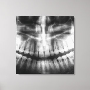Toile X-Ray Teeth Bouche sourire noir et blanc