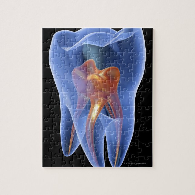 Tooth, transparent cross section of a molar jigsaw puzzle (Vertical)