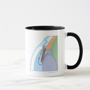 Trabeculectomy Procedure Mug