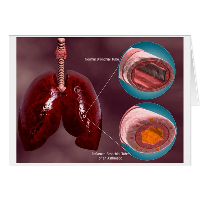 Trachea Cross-Section With Lungs (Front Horizontal)