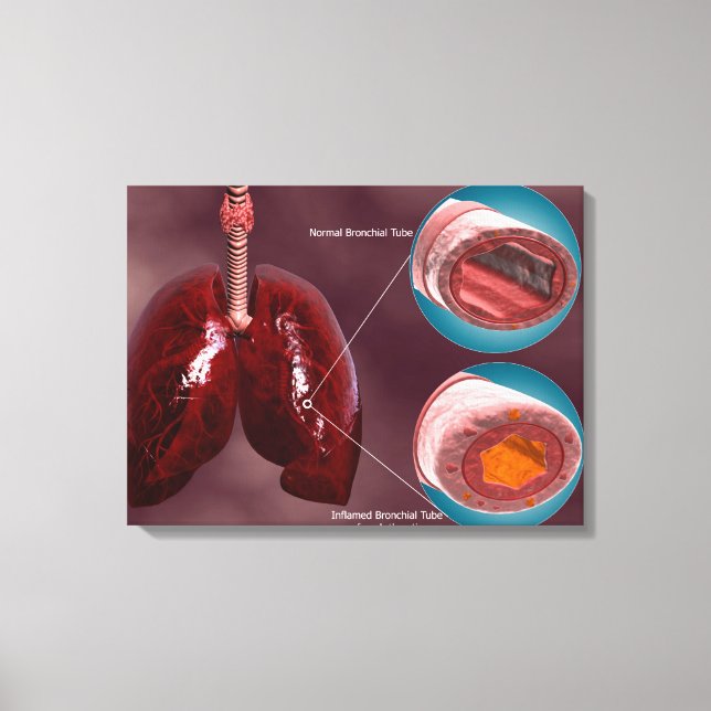 Trachea Cross-Section With Lungs Canvas Print (Front)
