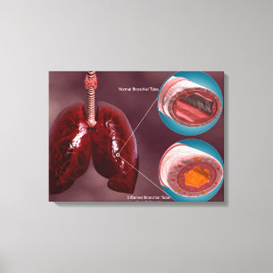 Trachea Cross-Section With Lungs Canvas Print