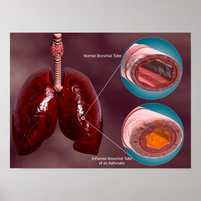 Trachea Cross-Section With Lungs Poster (Front)