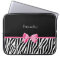 Trendy Black And White Zebra Print Pink Ribbon