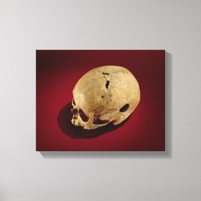 Trepanned Skull Canvas Print (Front)