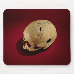 Trepanned Skull Mouse Pad