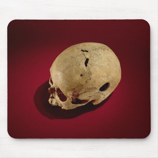 Trepanned Skull Mouse Pad (Front)